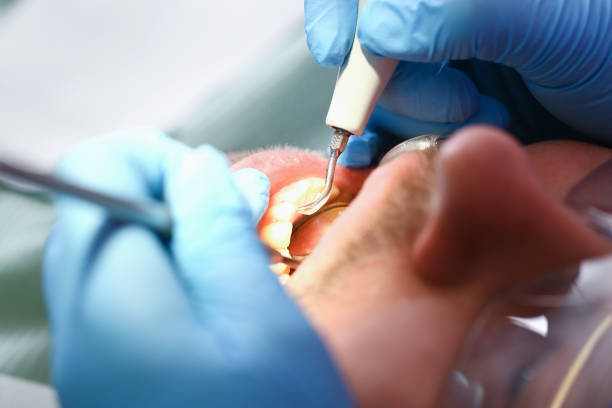 Best Emergency Tooth Extraction in Brownstown, PA