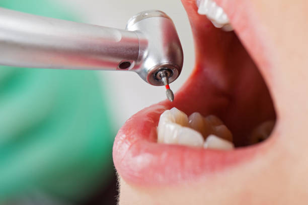 Best Same-Day Emergency Dental Services in Brownstown, PA